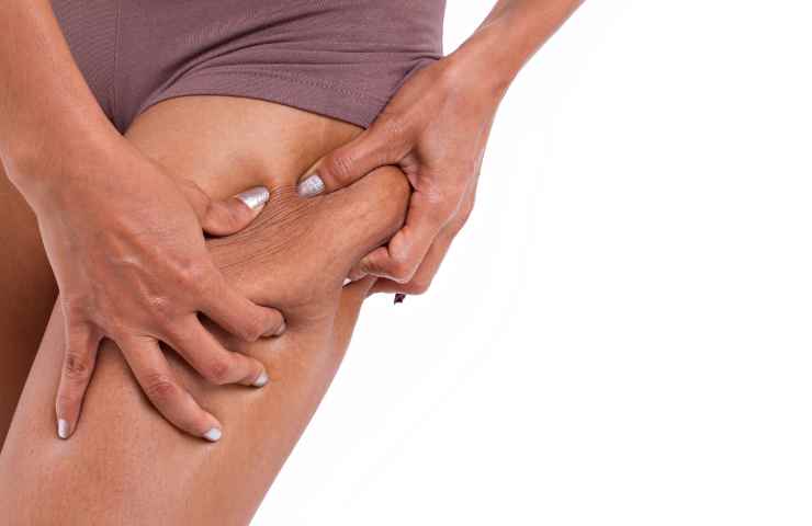 come togliere la cellulite 