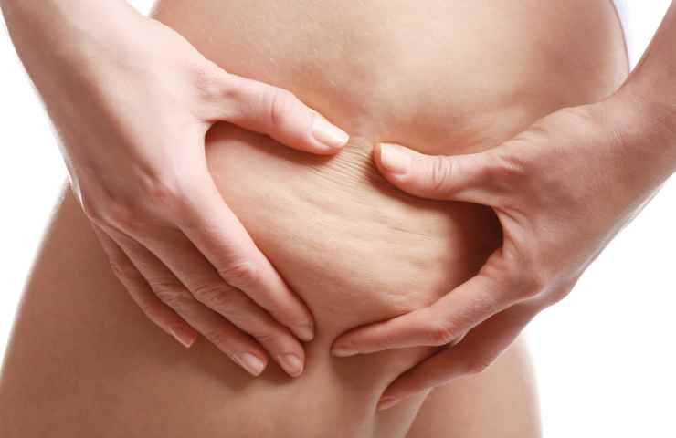 Eliminare la cellulite 